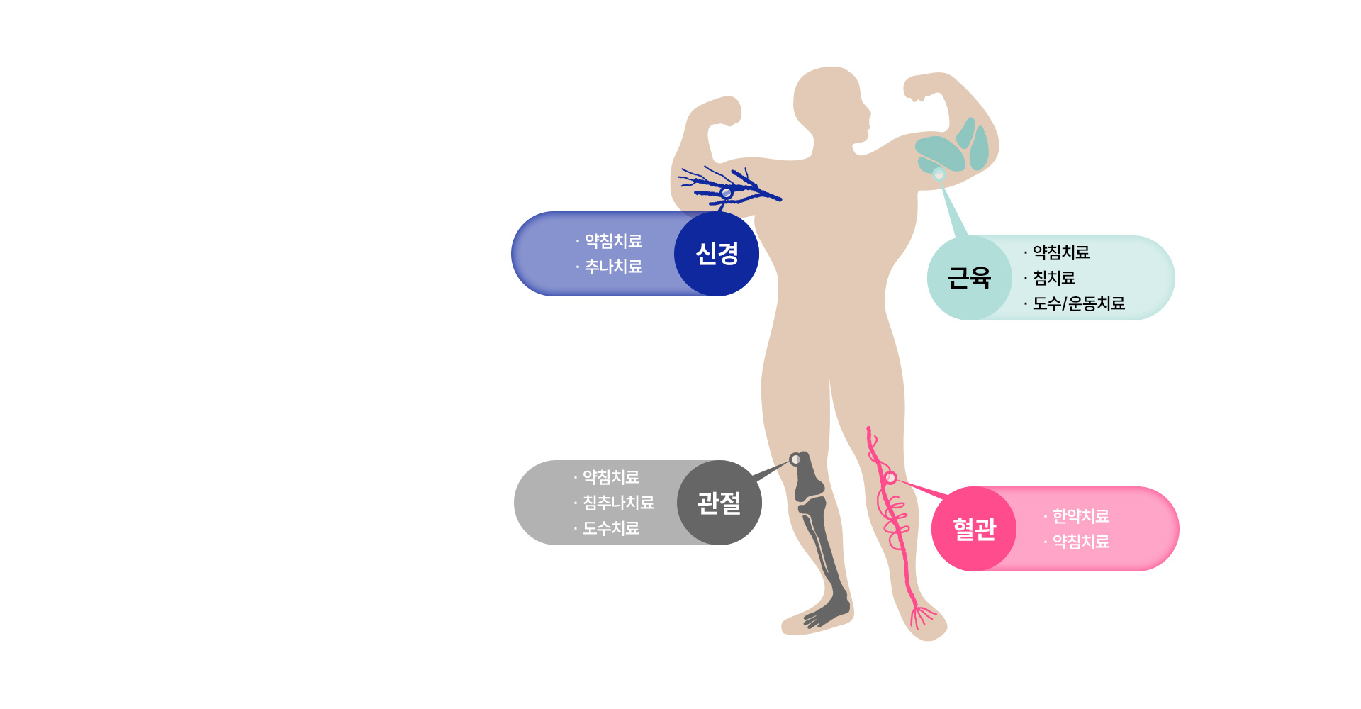 집중치료영역